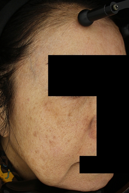 치료후기 이미지